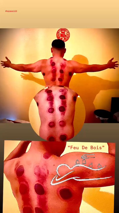 Diamond Massage - $20 Additional for Cupping Therapy. - Massage Therapy Near Me - Camarillo, California