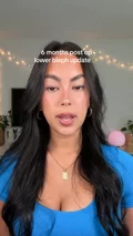 @jasanahis on what her lower blepharoplasty cost