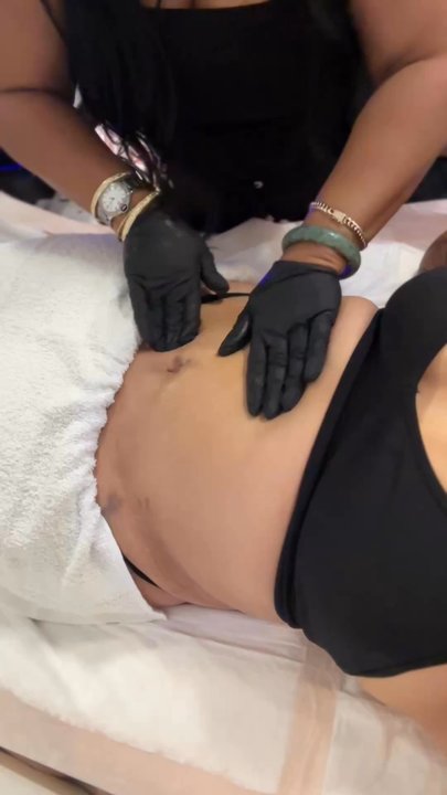 Beyou Bodycontour - Manual lymphatic drainage - Skin Care Near Me - Long Beach, California