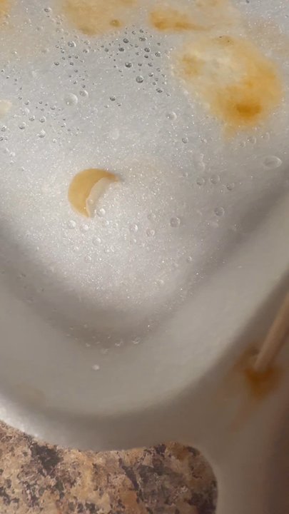 Dragon Garden Restaurant - This is me moving the finger nail tip around to show how hard it is and that it is not a piece of onion. - Chinese Near Me - Laplace, Louisiana