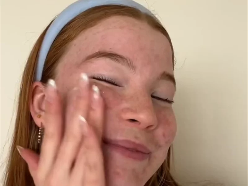 Skincare explanation + testimony