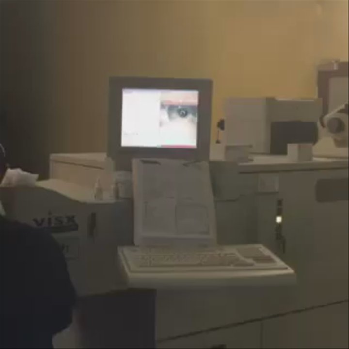 LasikPlus - This was the worst part in my opinion, putting the eyelid holders in lol! No pain, lots of pressure though! - Optometrists Near Me - Altamonte Springs, Florida