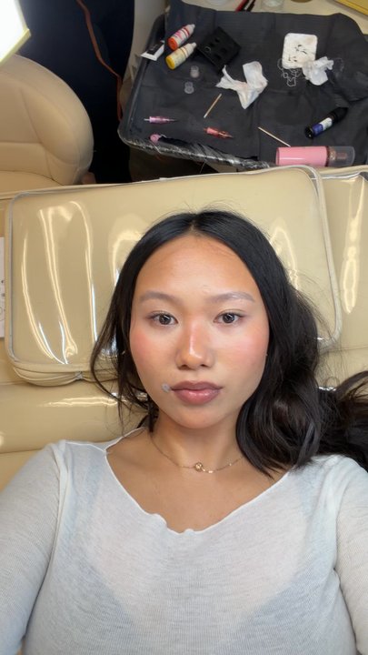 Nbeauty Studio - Before - Estheticians Near Me - Garden Grove, California