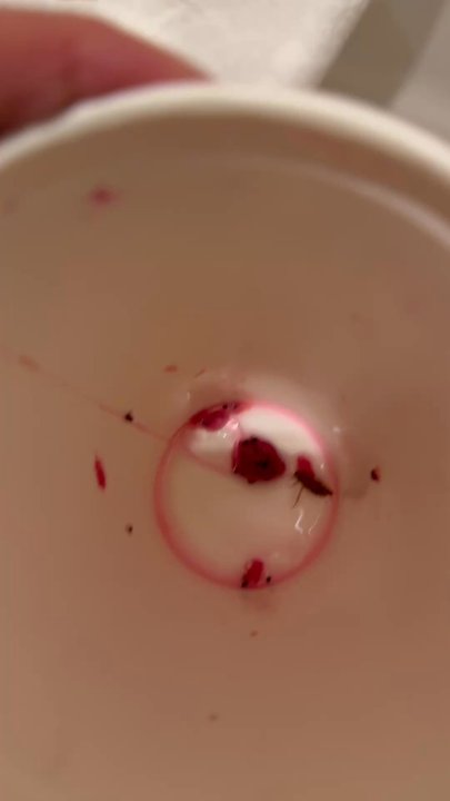 Starbucks - Bug in our drink - Coffee & Tea Near Me - Waipahu, Hawaii