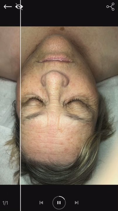 Hummingbird Esthetics - Skin Care Near Me - Monterey, California