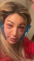 @shendelle, day 2 after a deep plane facelift