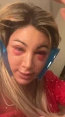@shendelle, day 2 after a deep plane facelift