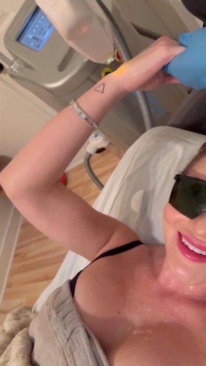 BodyBrite - Skin rejuvenation on hands, neck and chest - Laser Hair Removal Near Me - Baton Rouge, Louisiana
