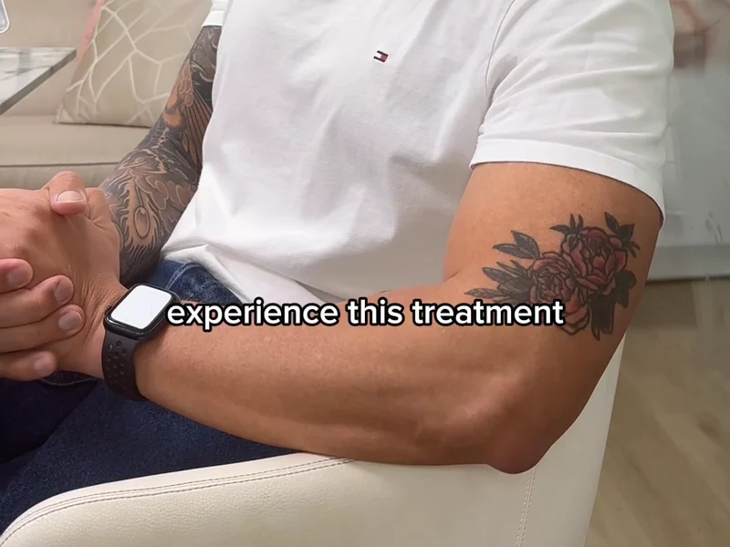 Trying XERF after losing 30kg
