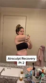 Amanda describes her own arm treatment cost