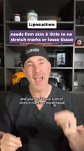 @dr.labrasca on skin limits
