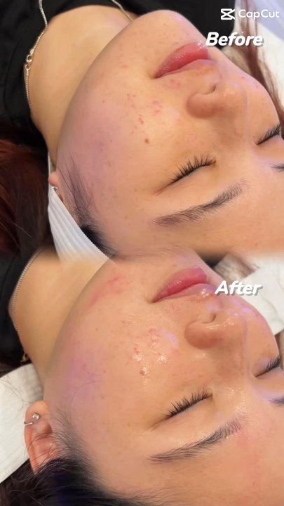 Korman Plastic Surgery & Wunderbar MedSpa - Medical Spas Near Me - San Jose, California