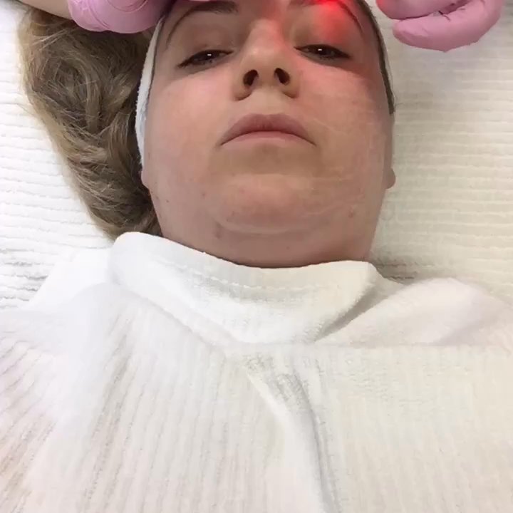 Florade Wellness Center - My Face God Alexa is the best!!!! - Medical Spas Near Me - Studio City, California