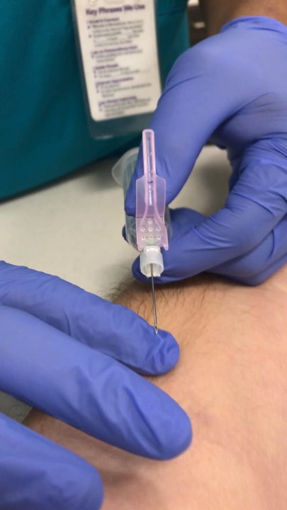 Michael L. Chang, DO - Drawing Blood! - Family Practice Near Me - Laguna Hills, California
