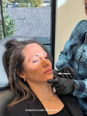 Skin Tightening result at Utah Facial Plastics & UFP Hair Restoration