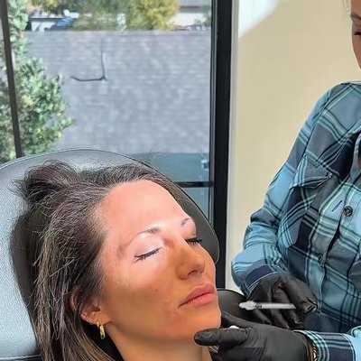 Utah Facial Plastics & UFP Hair Restoration skin tightening result — Salt Lake City, UT