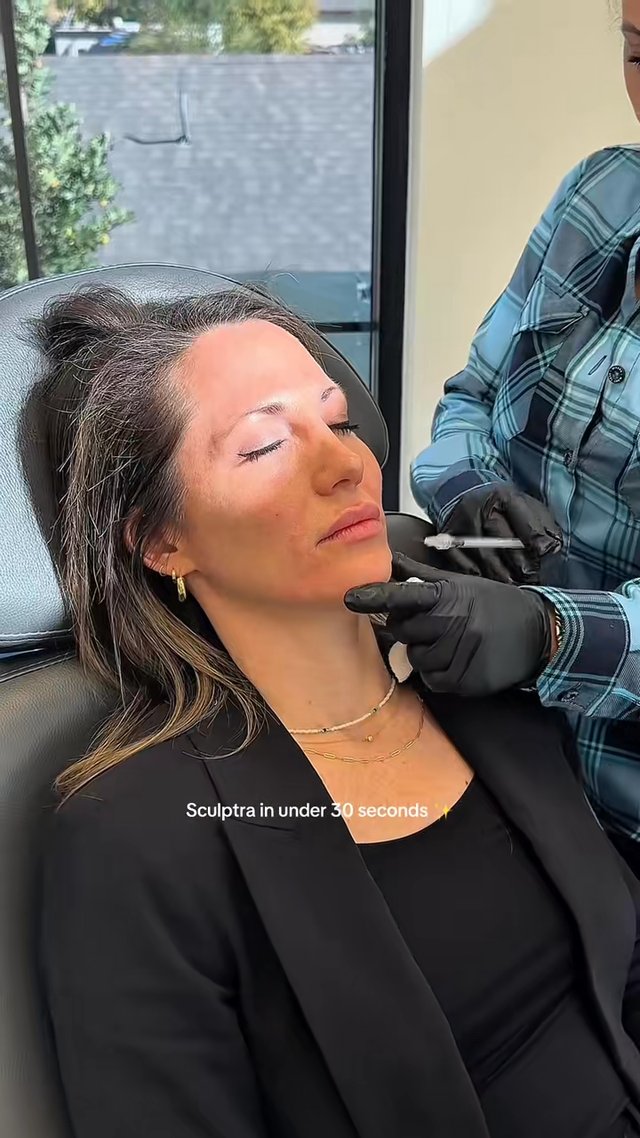 Skin Tightening result at Utah Facial Plastics & UFP Hair Restoration