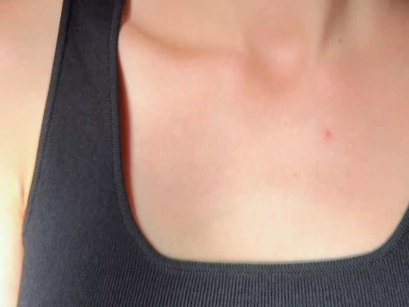 Aesthetic UGC - Skincare