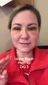 @glowbysallye, day 3 after upper blepharoplasty