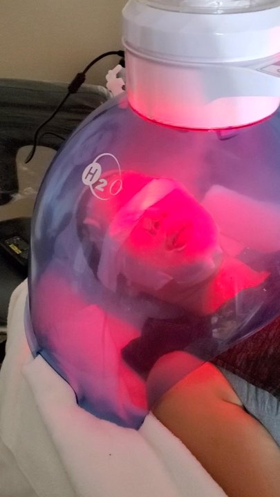 Esthetique by Grace M - Hydrogen Oxygen Treatment - Estheticians Near Me - Northridge, California