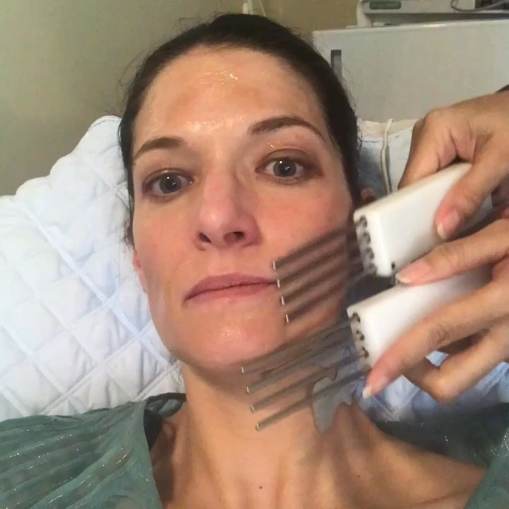 Skin Enthusiast - Neurotris Face and Body SX 3800 Microcurrent machine! It tightens muscles, brightens skin, texture is smoother & fine lines softened. - Skin Care Near Me - Bend, Oregon