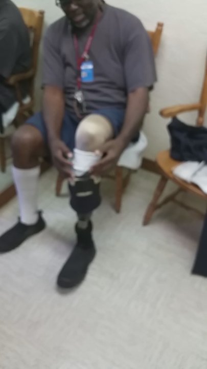 Kolman Prosthetics & Orthotics - Orthotics Near Me - Whittier, California