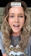 @ericamuellerhome, two weeks after upper blepharoplasty