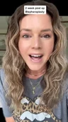 @ericamuellerhome, two weeks after upper blepharoplasty
