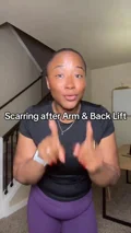 @janeelivinglean · Accepting the scar