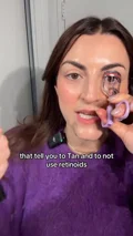 @charlotteparler describes a past Botox payment