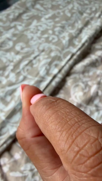 Alcosta Nails - Another nail about to fell off - Nail Salons Near Me - San Ramon, California