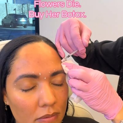22 Plastic Surgery & Spa MD botox result — Cottonwood Heights, UT