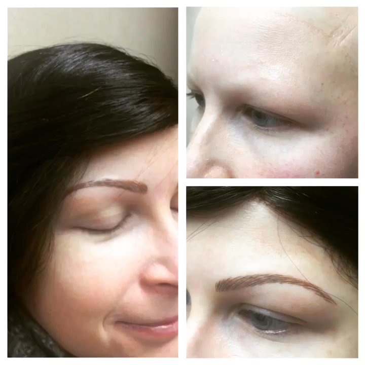 Cariangel's - Laser Hair Removal Near Me - Scarsdale, New York