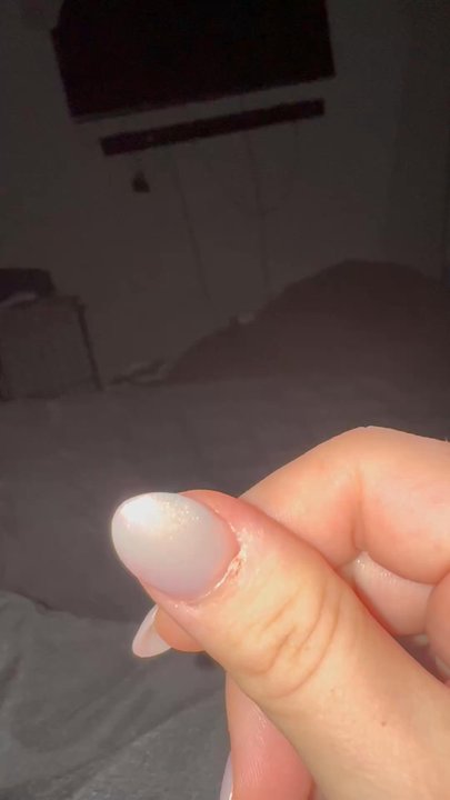 Nails & Beyond - Cuts on nails - Nail Salons Near Me - Fort Worth, Texas