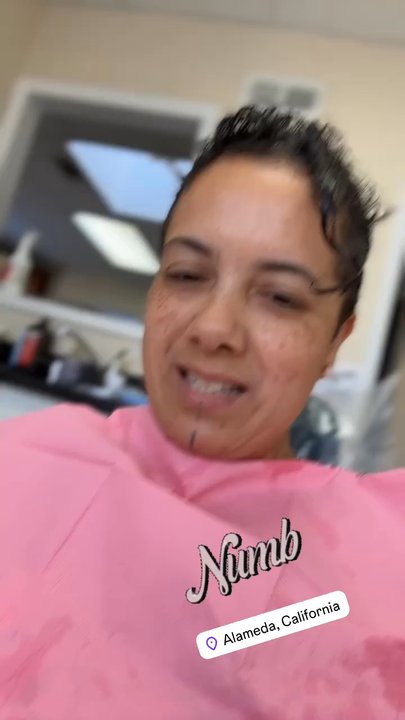 Randhawa Dentistry - Just got numb for fillings - Orthodontists Near Me - Alameda, California