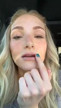 @maycietilley the day after lip filler