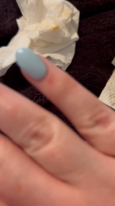 Sophora Nails & Spa - The cuts on my fingers :/ - Nail Salons Near Me - Abilene, Texas