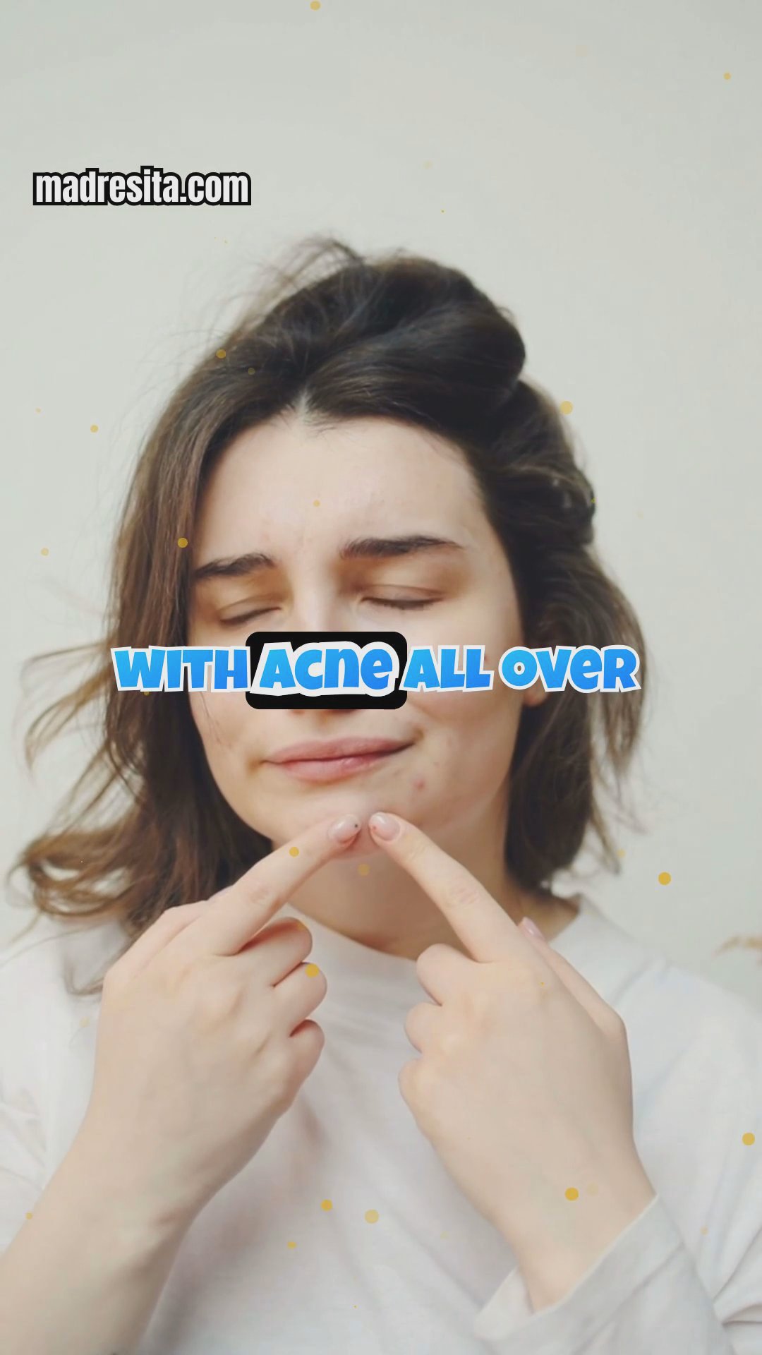 How Birch Chaga Truffles Transformed My Skin and Gut Health