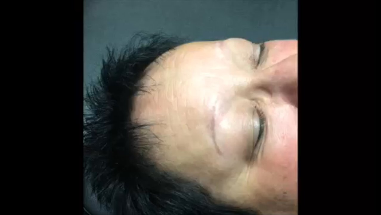 Kalon Salon by Jasmine Duster - She had a faded tan tattoo line no hair, 2nd video is after 8 months of her initial microblading,  3rd video is our first Maintence touch-up - Eyebrow Services Near Me - Murfreesboro, Tennessee