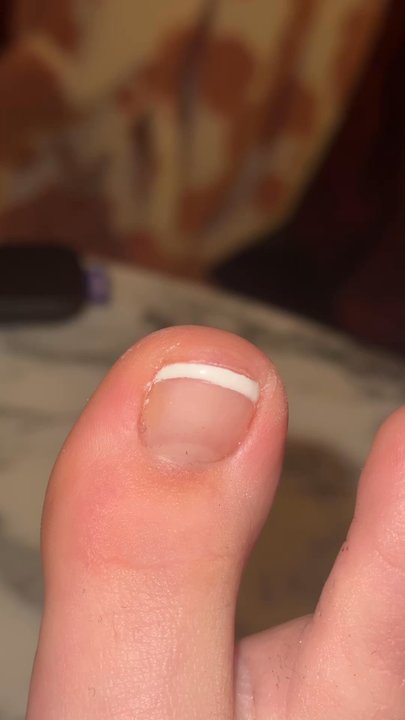Ambiance Nail Spa - Cuticles and bare under skin - Skin Care Near Me - Cincinnati, Ohio