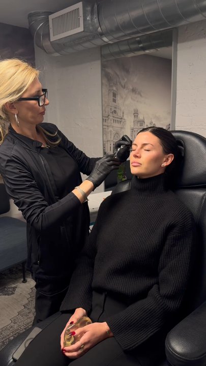 Rosenberg Plastic Surgery - Botox Botox Botox Treatment - Crow's Feet - Cosmetic Surgeons Near Me - Beverly Hills, California
