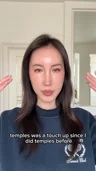 Violet describes her repeat facial fat transfer rounds