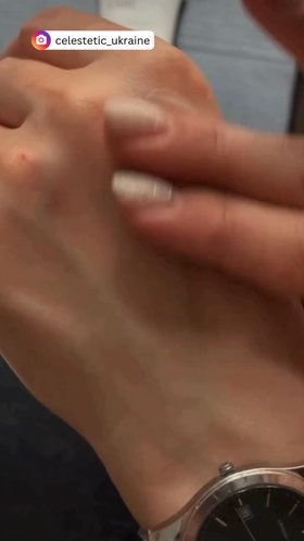 Hand Care