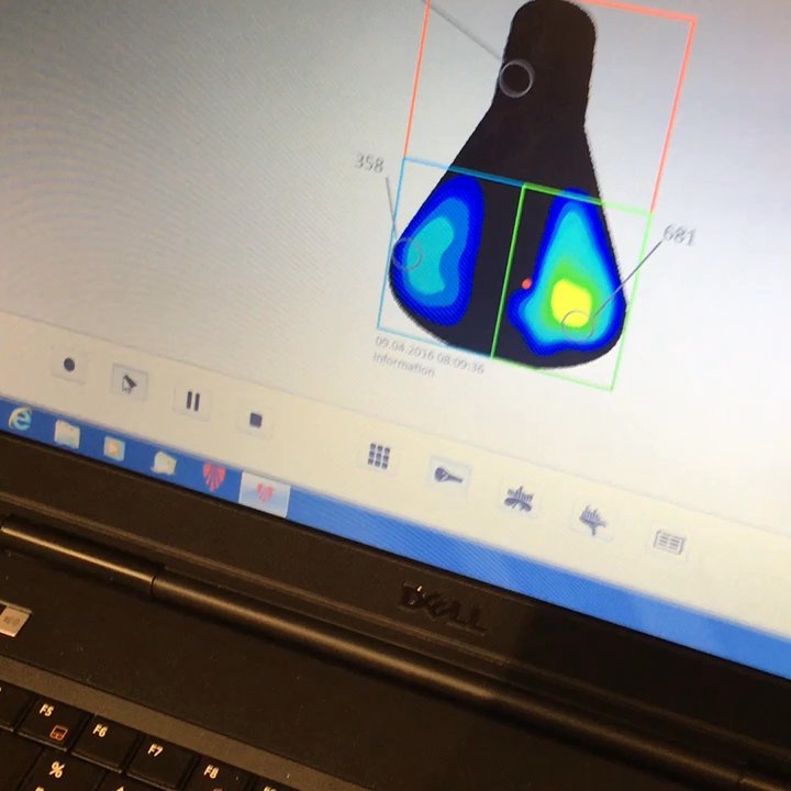 Trek Bicycle Store - Real time video pressure analysis tool. - Bikes Near Me - Naperville, Illinois