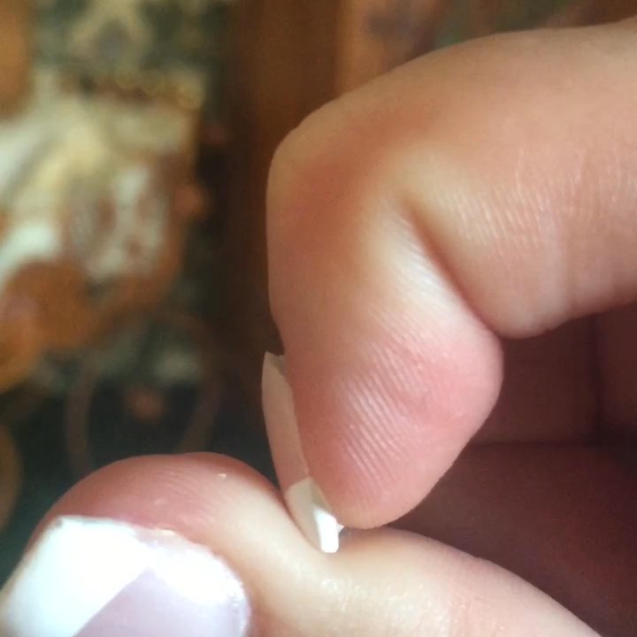 Venetian Nails - Should acrylic nails pop up like this in less than 24 hours ? - Nail Salons Near Me - Deer Park, New York