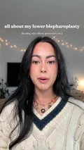 @jasanahis on her transconjunctival lower blepharoplasty