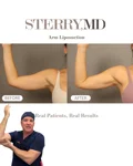 @therealdrsterry on arms