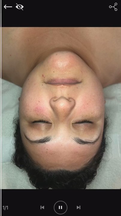 Hummingbird Esthetics - Skin Care Near Me - Monterey, California