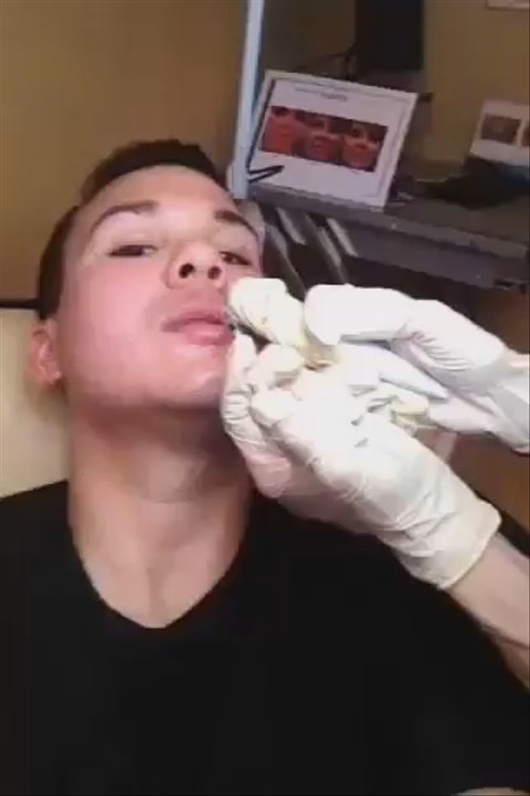SkinSpaMED Dallas - Marie injecting Juvederm Ultra into my lips! - Skin Care Near Me - Dallas, Texas