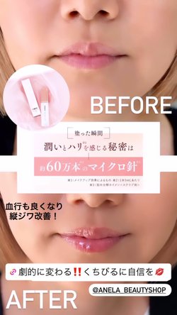 MWAH NEEDLE LIPS【塗るリップ美容針】 – ANELAONLINE